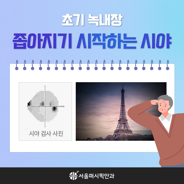 서울퍼시픽안과_44차_일러스트카드뉴스(녹내장진행속도)03.jpg